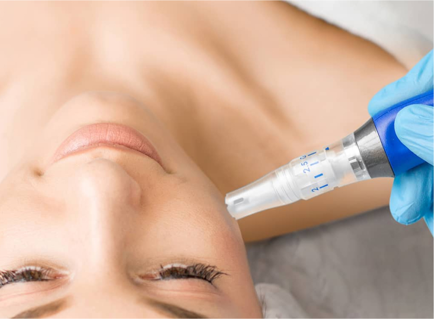 SKINPEN microneedling