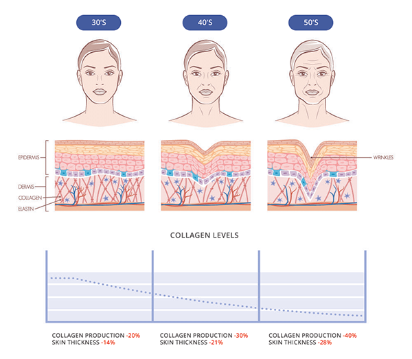 BTL EXILIS