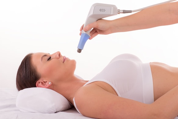 BTL EXILIS σύσφιξη και ανόρθωση προσώπου