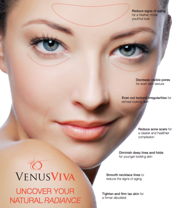 Venus Viva Nano Fractional RF Θεραπεία ρυτίδων