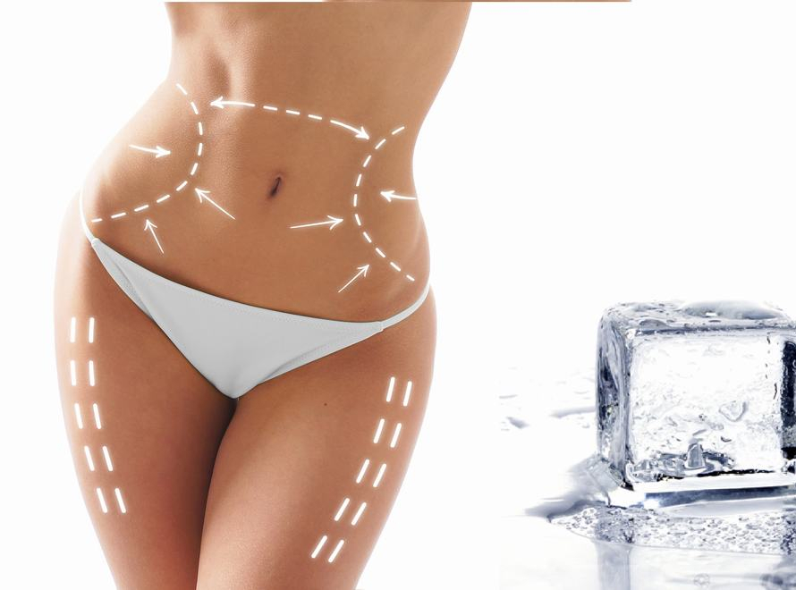 ΚΡΥΟΛΙΠΟΛΥΣΗ LIPOFREEZE